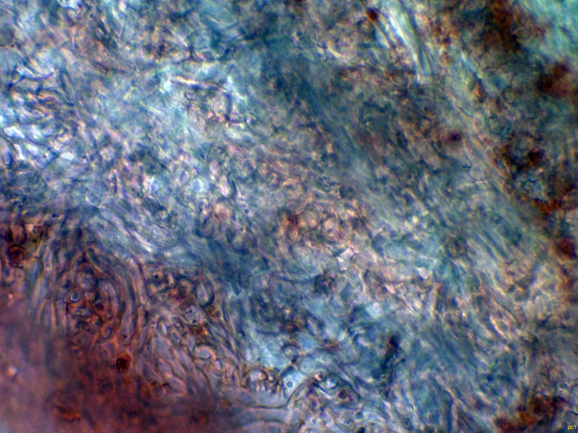 Microscopía de Elaphomyces granulatus - 10 - Hifas peridio parte interna-001